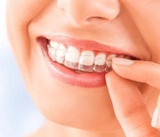 Invisalign, Phillips Ranch – Family & Cosmetic Dentistry