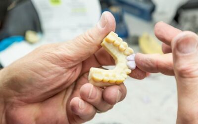 3D Printing A New Trend In Dentistry