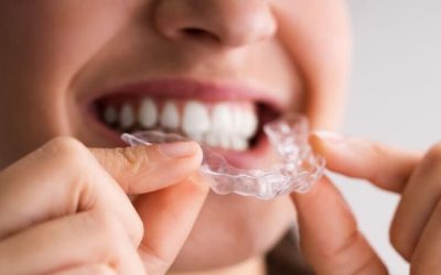 Invisalign…Is It Right For You?