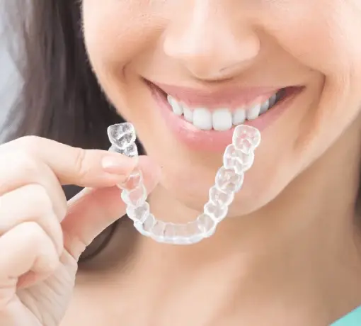 SWITCH OVER TO INVISALIGN IN 4 EASY STEPS