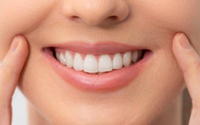 Say Goodbye to Stains: Understanding the Benefits of Professional Teeth Whitening